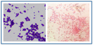 Two pictures of bacteria with Gram-positive on the left and Gram-negative on the right.