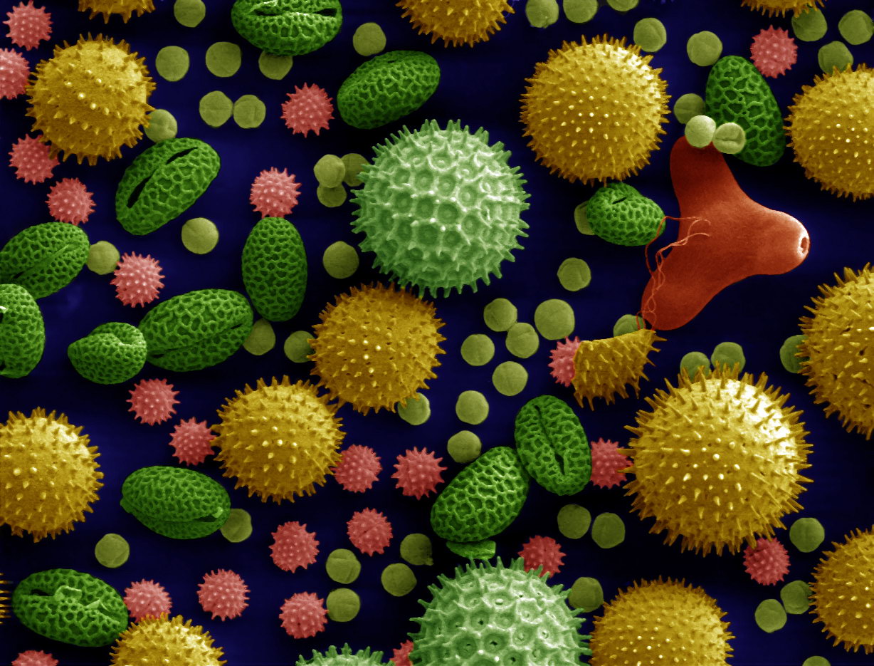 Pollen grains viewed under a high-powered microscope.