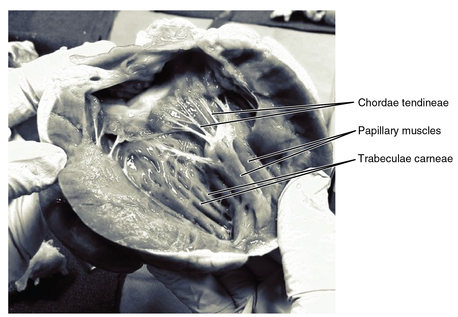 This photo shows the inside of the heart with the main muscles labeled.
